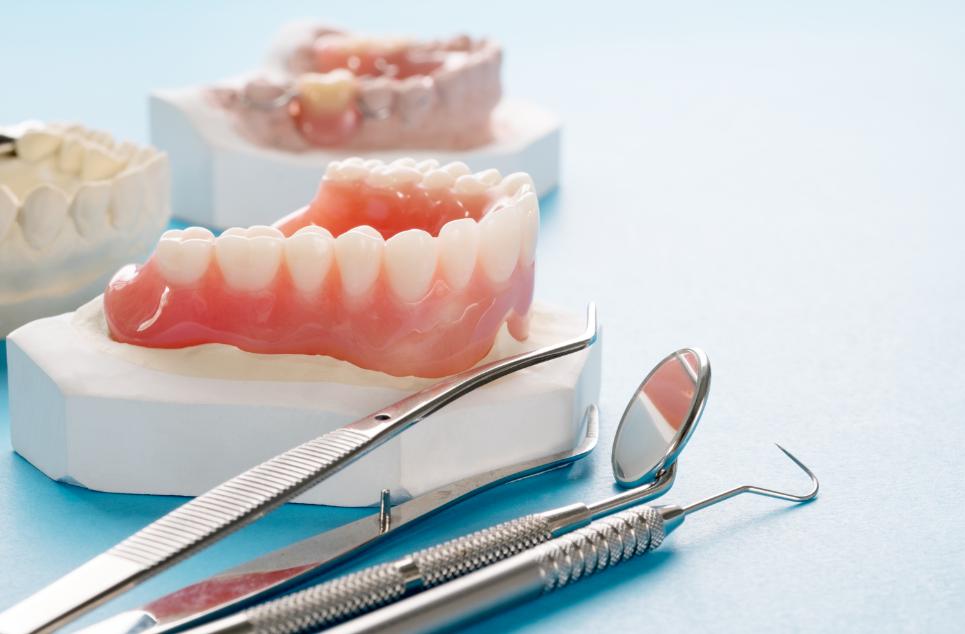 dental-crown-bridge